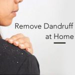 Remove-Dandruff-naturally-at-Home01