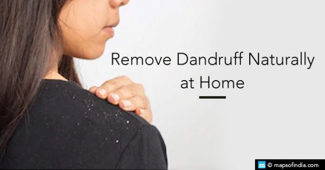 Ayurvedic Remedies To Get Rid Of Dandruff - India