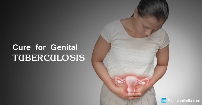 Genital Tuberculosis