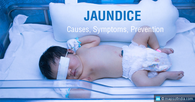 Jaundice - Causes, Symptoms and Prevention