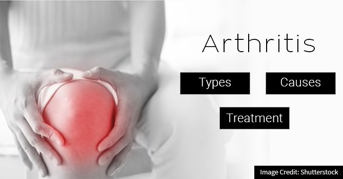 Arthritis: Types, Causes, & Treatments