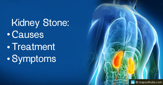 Image Showing Kidney Stone