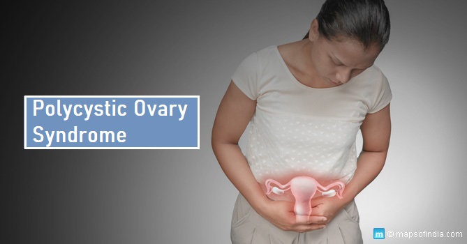 Polycystic Ovary Syndrome
