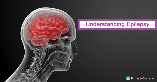 Understanding Epilepsy