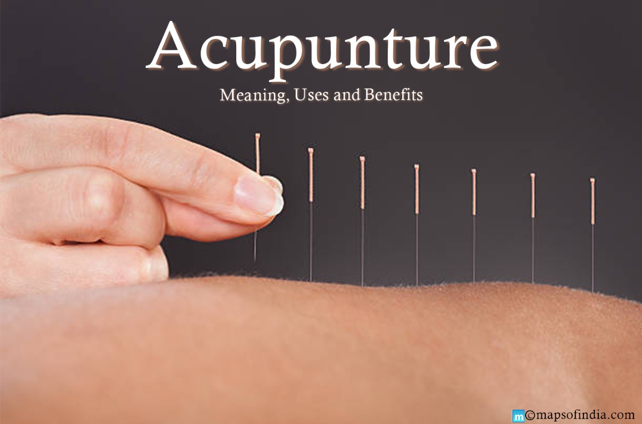 Acupuncture: Meaning, Uses and Benefits