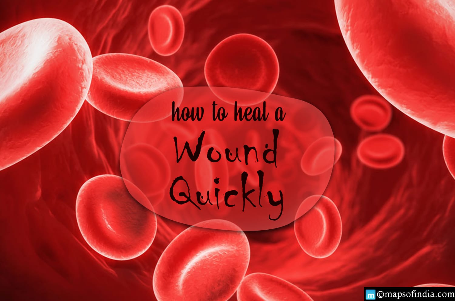 How to heal a wound quickly?