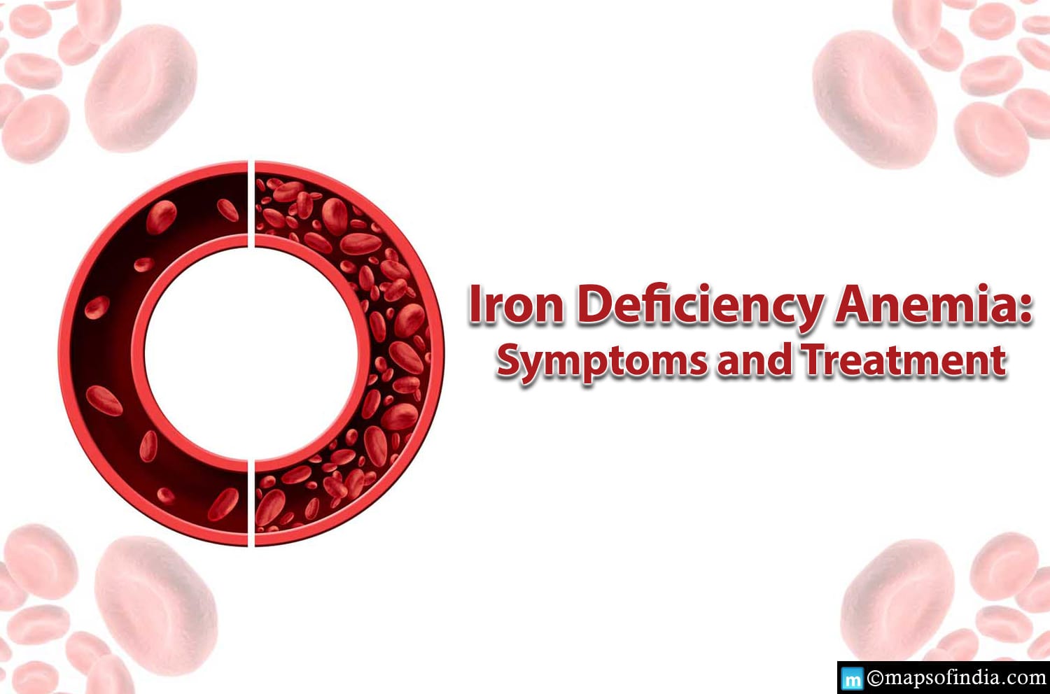Iron-Deficiency Anaemia: Symptoms and Treatment