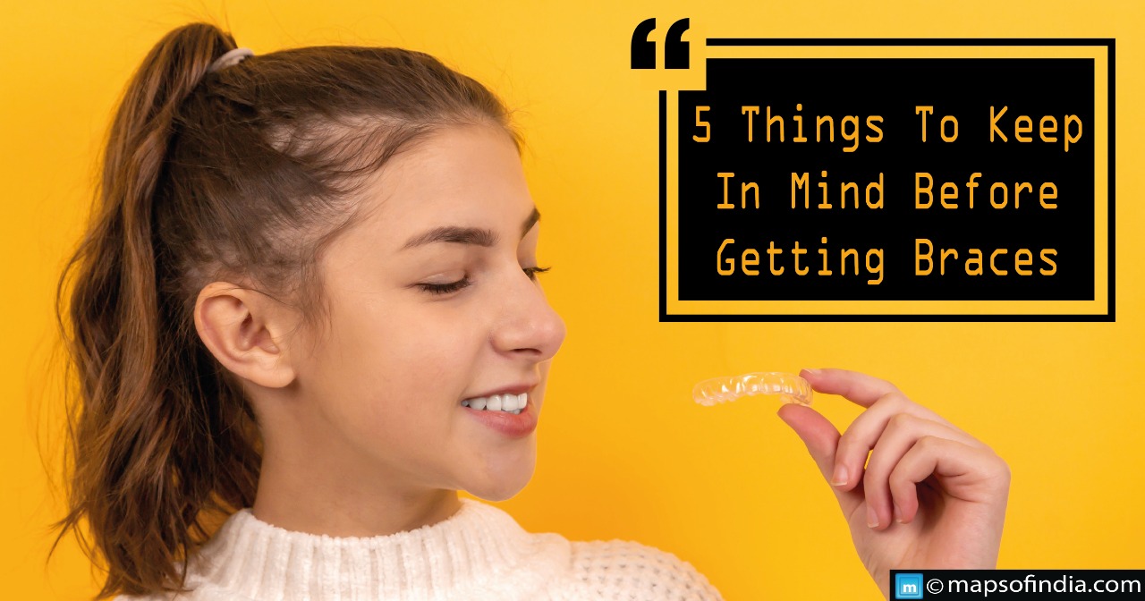 Five things to keep in mind before getting braces