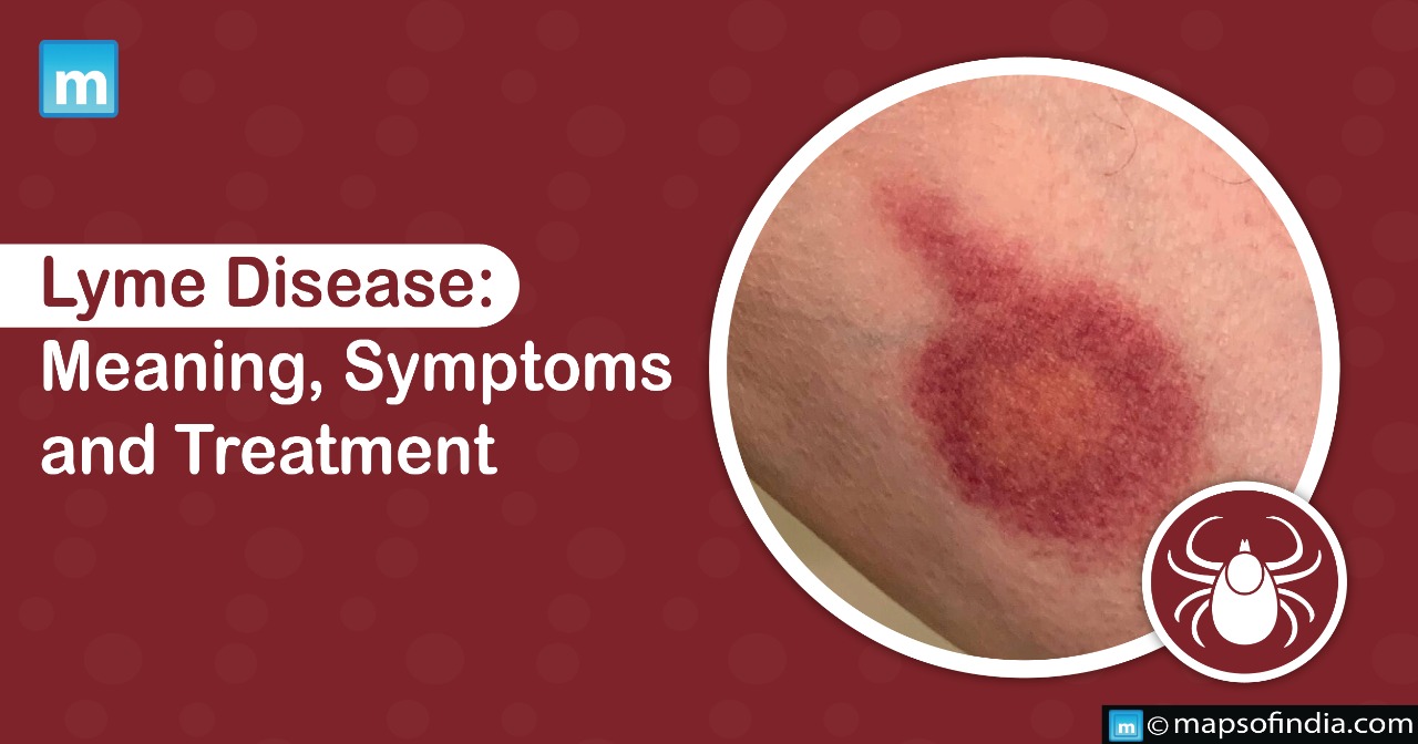 Lyme Disease: Meaning, Symptoms and Treatment