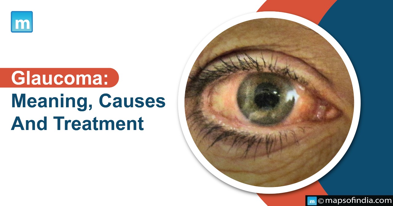 Glaucoma: Meaning, Causes And Treatment