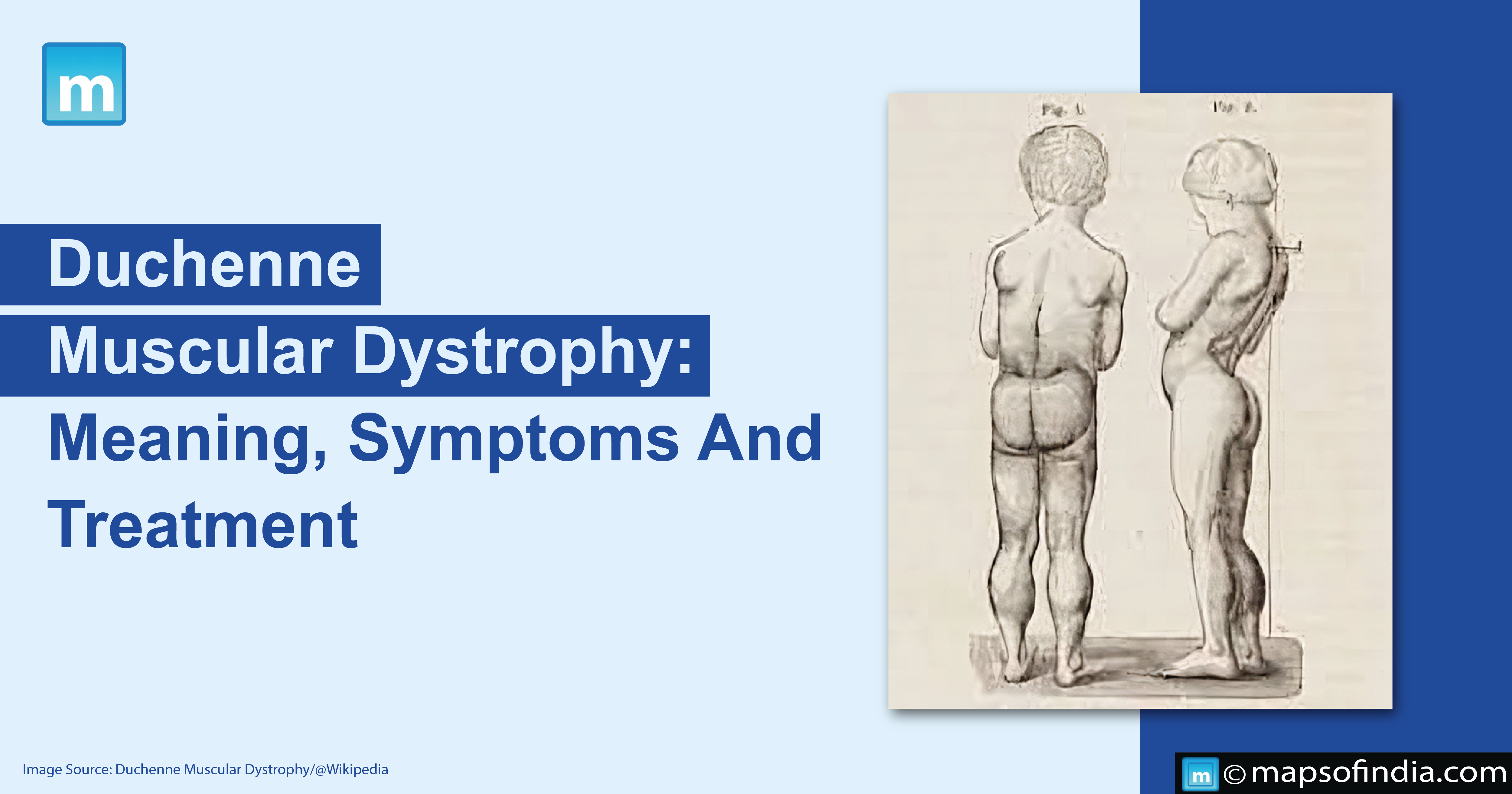 Duchenne Muscular Dystrophy: Meaning, Symptoms And Treatment
