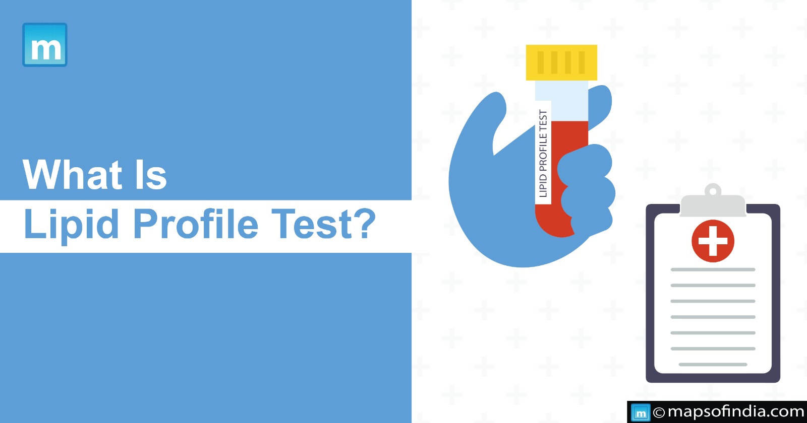 What Is Lipid Profile Test?