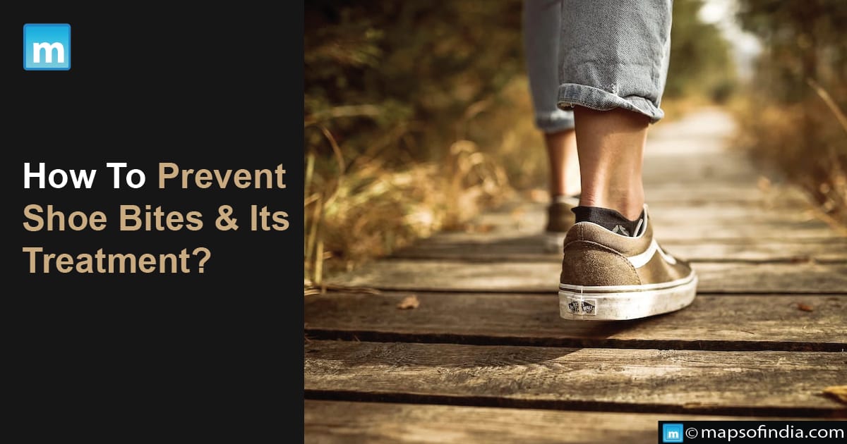 How To Prevent Shoe Bites And Its Treatment?