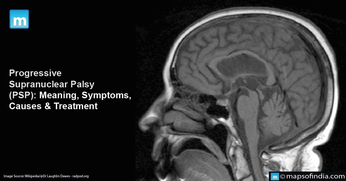 Progressive Supranuclear Palsy: Meaning, Symptoms, Causes & Treatment