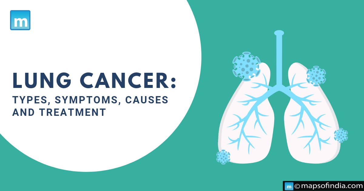 Lung Cancer: Types, Symptoms, Causes And Treatment