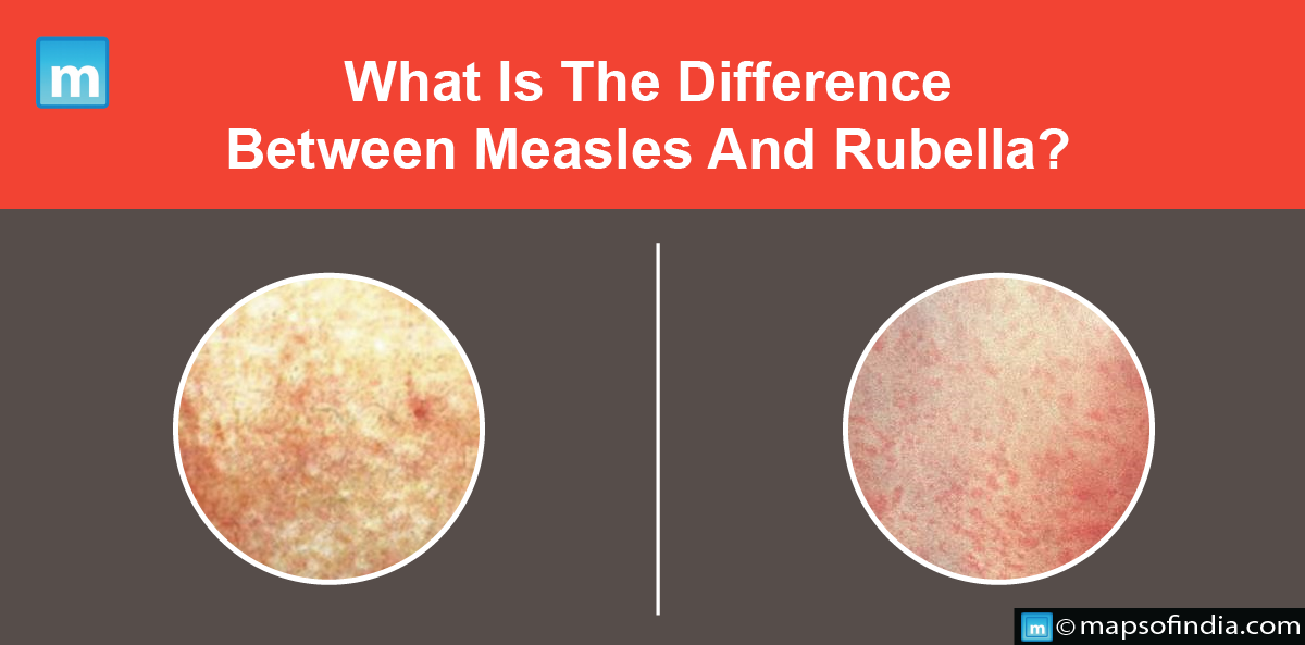 What Is The Difference Between Measles And Rubella?