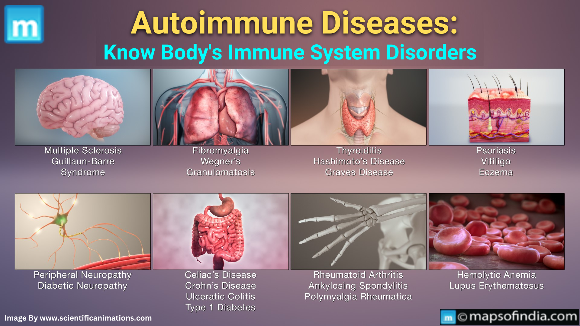 Autoimmune Diseases: Know Body's Immune System Disorders