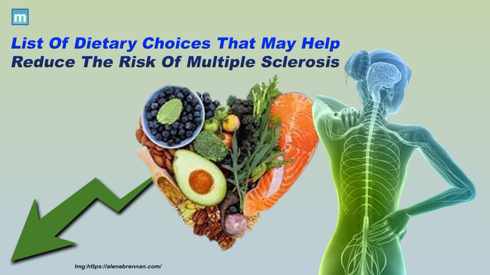 List Of Dietary Choices That May Help Reduce The Risk Of Multiple Sclerosis