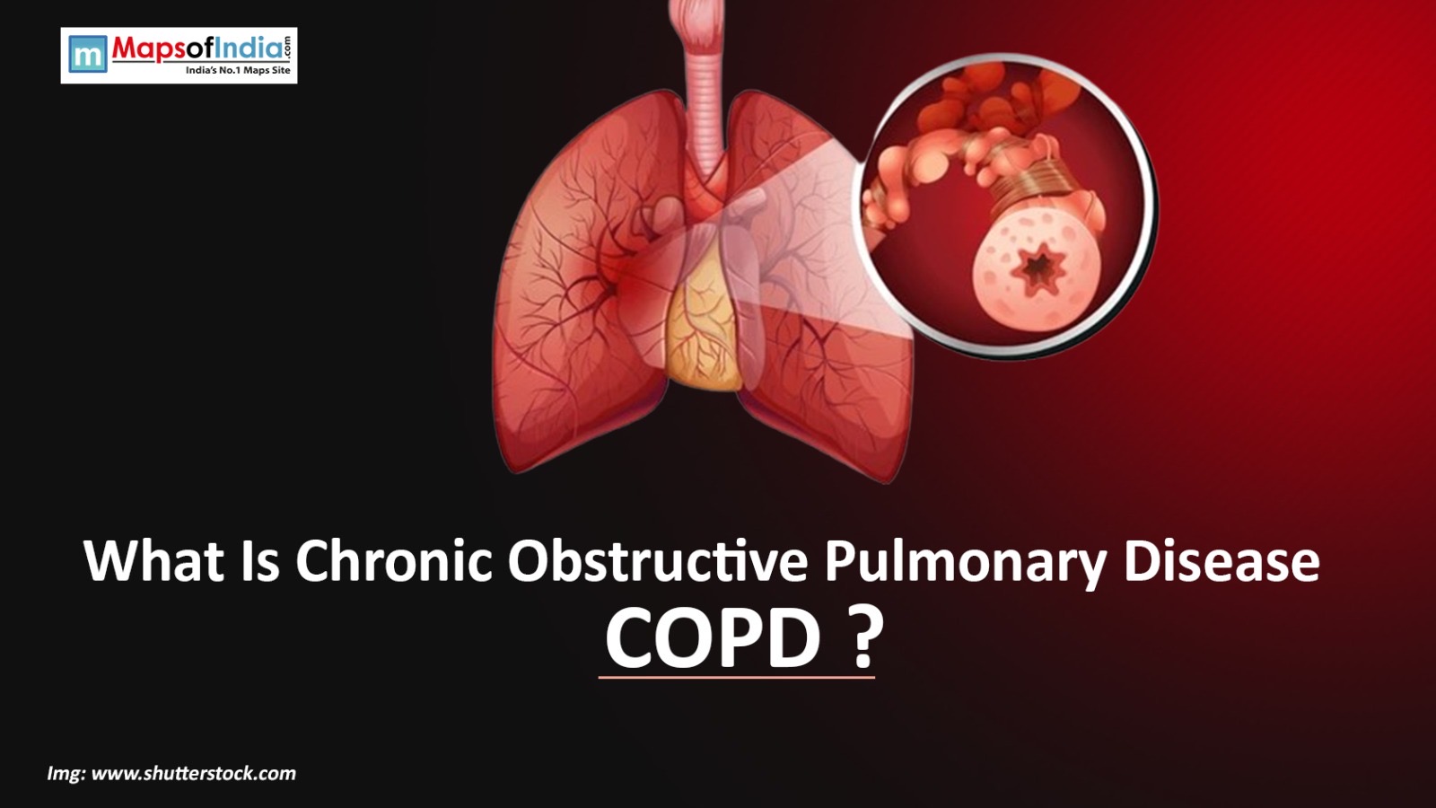 What Is Chronic Obstructive Pulmonary Disease (COPD)?